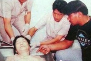 邓丽君去世后尸检死亡真相-脸上有明显的手掌印