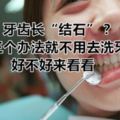 牙齒長「結石」？用這三個辦法就不用去洗牙了！好不好來看看