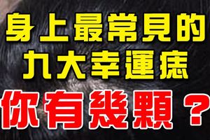 身上最常見的九大幸運痣，你有幾顆？