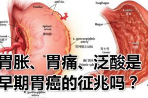 胃脹、胃痛、泛酸是早期胃癌的徵兆嗎？