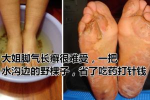 農村大姐腳氣長癬很難受，一把水溝邊的野棵子，省了吃藥打針錢