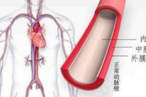 四種人群注意別把胸背痛不當回事！