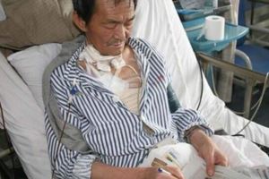 3種癌症死亡率最高，遺傳率也高，爸媽患病子女也難逃！