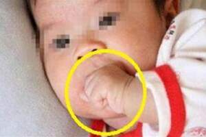 6個月寶寶握緊拳頭不放，奶奶發現不對送醫檢查，醫生：已經晚了。
