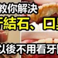 「牙結石口臭難消除？」教你簡單天然辦法，不必看醫生，牙結石譁譁往下掉！