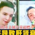 吃自助餐後喝涼茶　男離奇中毒肝腎衰竭