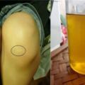 [鳳梨+蘋果]拯救你的膝蓋，每天喝一杯，幫助膝蓋軟骨重生，皮膚也細膩了！