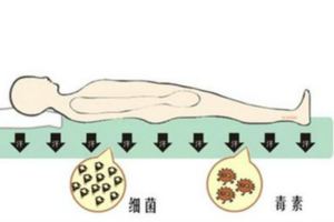 教你5招，強力清殺百萬蟎蟲大軍，令其無處可藏！