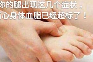 你的腿出現這幾個症狀，當心身體血脂已經超標了！