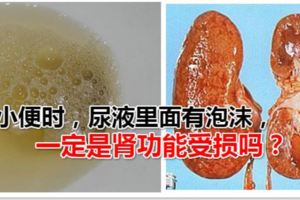 小便時，尿液裡面有泡沫，一定是腎功能受損嗎？