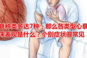 心衰種類多達7種，那麼各類型心衰的臨床表現是什麼？個別症狀很常見！