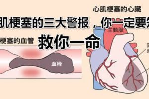梗塞）心肌梗塞的三大警報，你一定要知道高血壓性心髒病、冠狀動脈心髒病（心絞痛、心肌