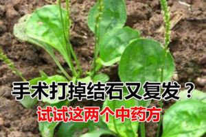 做手術打掉結石又復發？試試這兩個中藥方