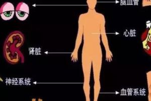 這個方子，多少糖友求之不得，老中醫免費公開，看到就快收藏了