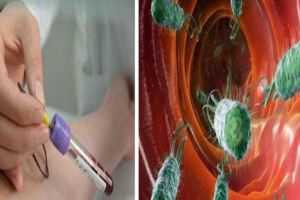 能殺死幽門螺桿菌的2個方法，很常見易行，只需堅持