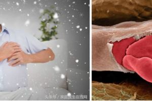 血液一粘稠，人就離死神更近！5個方法輕松預防它
