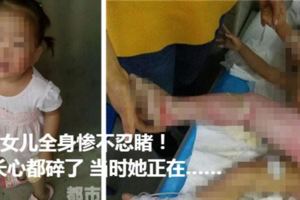 2歲女兒全身慘不忍睹！家長心都碎了當時她正在……