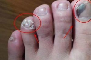 醫生都害怕：如果腳部有這5種症狀就要小心了，太危險了！