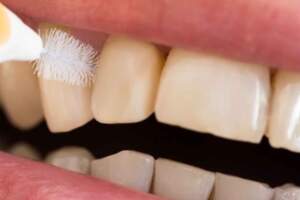 明明每天都有刷牙，為何還是滿口大黃牙？3個原因，你可曾考慮？