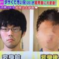 20歲男大生從小被叫醜八怪自我放棄連妹妹都假裝沒哥哥，直到節目組幫他大改造，一秒變男神！！