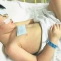 患罕見病多次中風男童剩1條腦血管供血