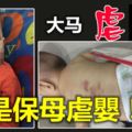 【大馬新聞】又是保母虐嬰！男嬰眼紅腫背瘀青