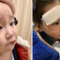 趙文卓在微博曬出兩張女兒受傷的照片，女兒臉部受傷縫七針趙文卓直喊心疼