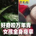 好奇咬萬年青，4歲女童全身痙攣，口吐白沫。。。。。