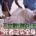 不甘戴綠帽打死小王死者證實全身骨折