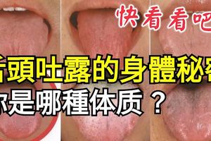 舌頭吐露的身體秘密：你是哪種體質？快看看吧！