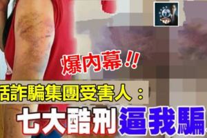 「７大酷刑逼我騙人!!」電話詐騙集團大馬女「同夥」，竟然也是受害人~~她身上傷痕累累觸目驚心……