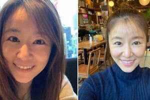 42歲林心如曬照說自己臉腫成豬頭睜不開眼，都是因為這件事惹的禍！