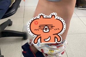 在國外工作將孩子給保母托育，被幼兒園發現身上有大傷口，詢問保母卻推託再三說詞含糊，惡劣行徑令人難以忍受！