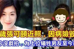 47歲張可頤近照，因病險毀容如今沒戲拍，為上位犧牲男友至今單身！