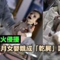 滿月女嬰餓成「乾屍」體重只有1900克　張大嘴卻哭不出聲讓人心酸