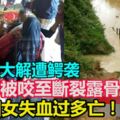 河邊大解遭鱷襲，右腳被咬至斷裂露骨，婦女失血過多亡！