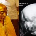 將中國寺廟內的「千年黃金佛像」送去做X光，掃描後發現「佛像頭部」竟然有異物！