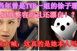 【徐子珊再整容！？】當年曾是TVB一姐的徐子珊疑再整容而且還漂白！？粉絲大喊：這真的是她本人嗎！？