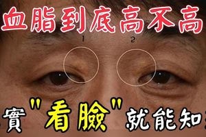 血脂到底高不高，其實「看臉」大家就能知道！