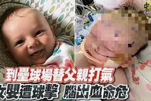 到壘球場替父親打氣女嬰遭球擊腦出血命危