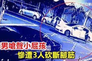 醉男嗆聲小屁孩慘遭3人砍斷腳筋