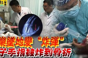 將汽水放入冰箱冷藏，可樂墜地變」炸彈「！男子手指被炸到骨折