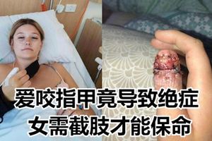 愛咬指甲竟導致絕症女需截肢才能保命