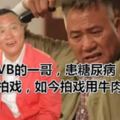 曾經TVB的一哥，患糖尿病，4年沒拍戲，如今拍戲用牛肉刀剃頭