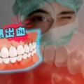 你會牙齦出血嗎？可能是大病的徵兆！趕緊看看！