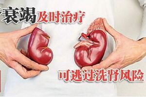 腎衰竭及時治療可逃過洗腎風險