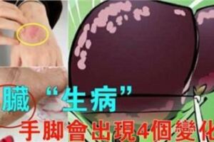 肝臟一旦「生病」了，手腳會出現4個變化，你若一個也沒有，肝臟還很健康