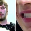 21歲帥氣男子自爆「出生後從沒刷牙」！當他一張開嘴巴「超恐怖畫面」...牙醫：只能全打掉！