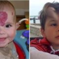 男童出生就「長血管瘤」毀了整張臉，醫生替他手術卻「變成惡魔角」...最後模樣讓爸媽激動落淚！