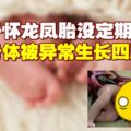 夫妻喜迎龍鳳胎　孩子出生嚇著了醫生